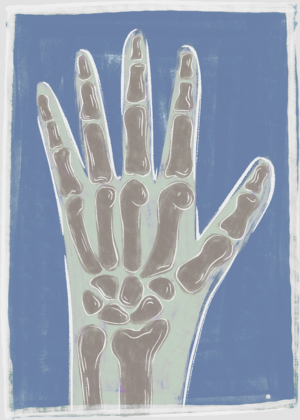 Arthritis Assistant Logo